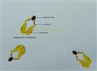  Translator apparatuses each  with 2 yellow pollinia, stalk like caudicles joined with  black corpusculum